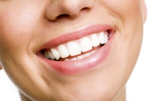 Fluoride Treatment Smile