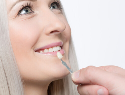 What is the Right Age for Porcelain Veneers?