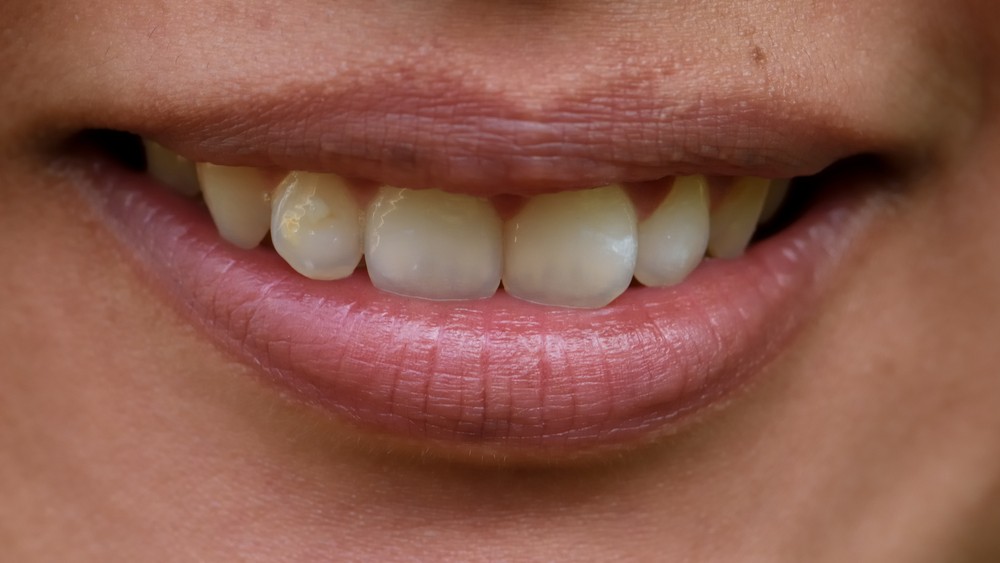How to Get a Good Smile with Bad Teeth Medical Center