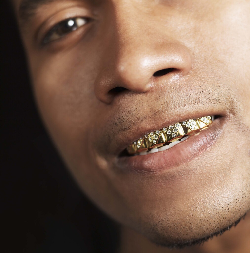 Man with gold teeth grill Ingenious Dentistry