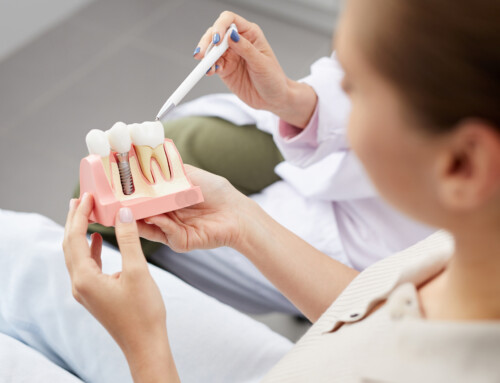 Bridges vs. Dental Implants: What’s Right for You