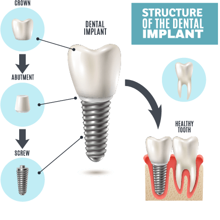 Dental Image