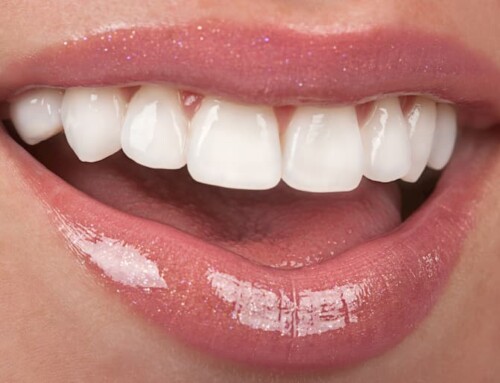 Considering a Dental Makeover? What all is involved?