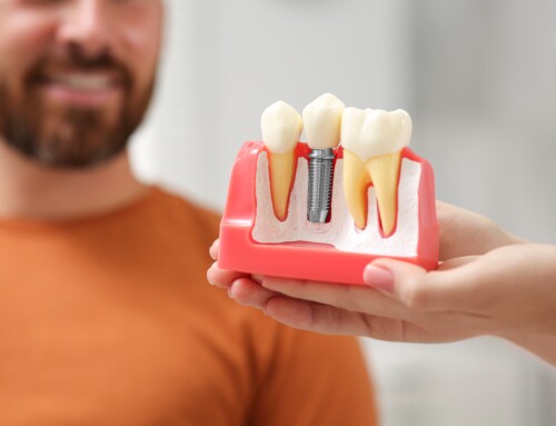 Root Canal vs. Dental Implant: Choosing the Right Treatment